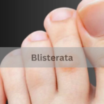 Blisterata