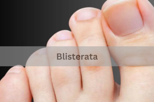 Blisterata