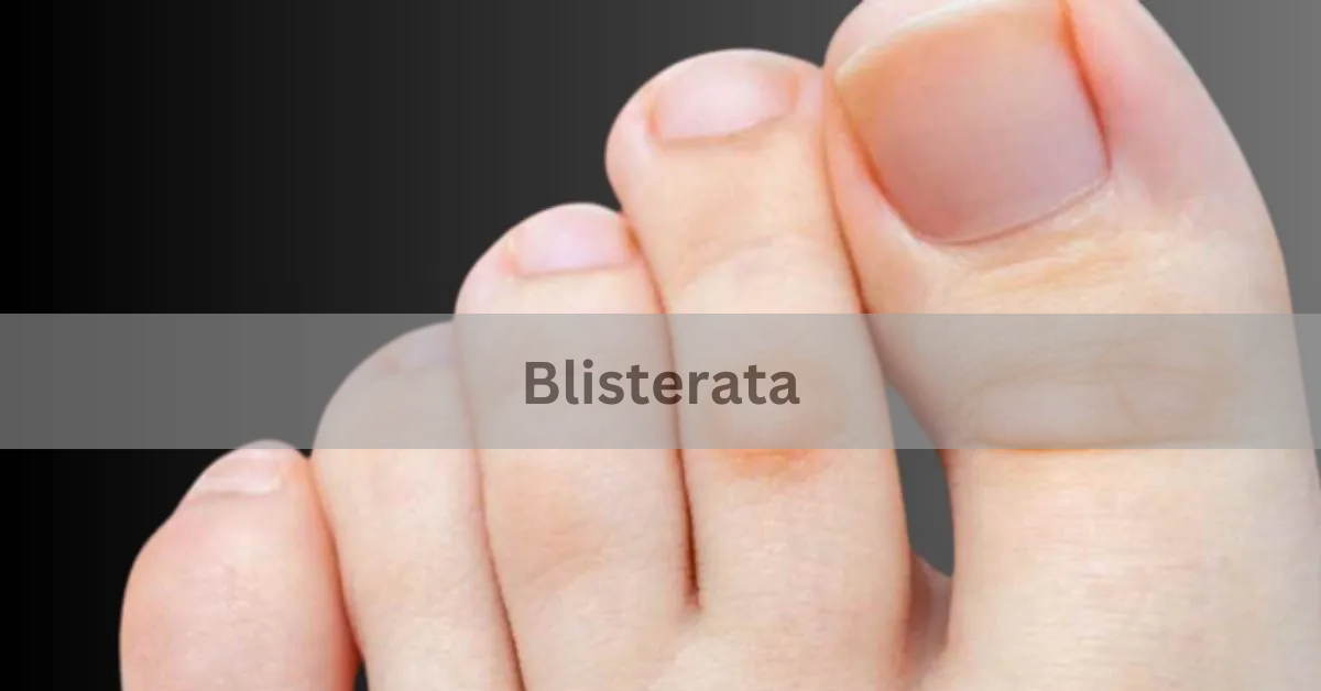 Blisterata